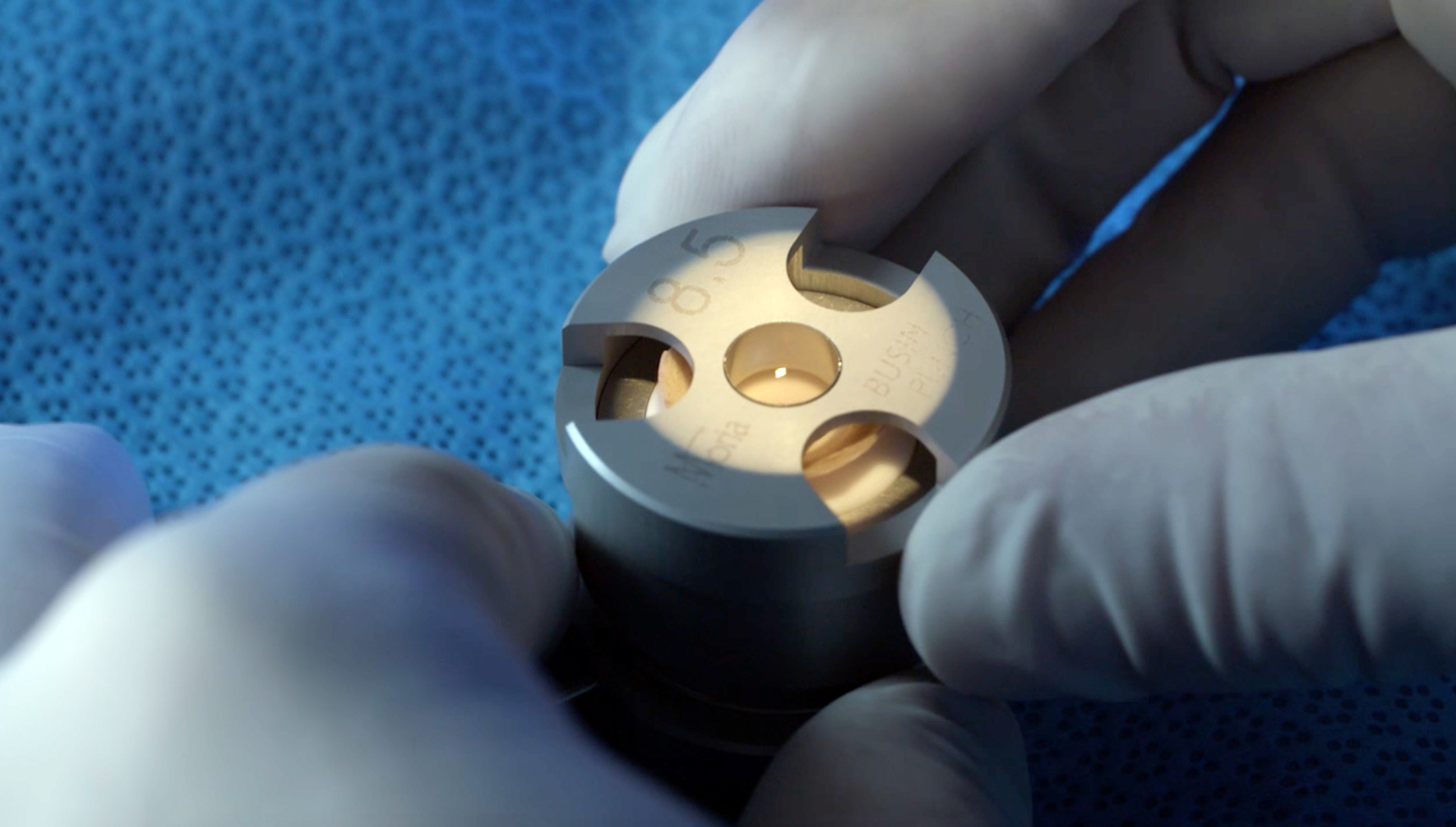 DMEK procedure Miracles In Sight
